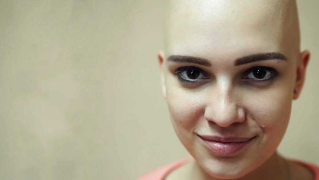 go to Mit erhobenem Glatzkopf: Mädchen aus Russland hat Mut